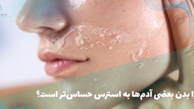 حساسیت به استرس