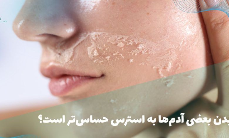 چرا بدن بعضی آدمها به استرس حساستر است؟ (حساسیت به استرس) 1 حساسیت به استرس